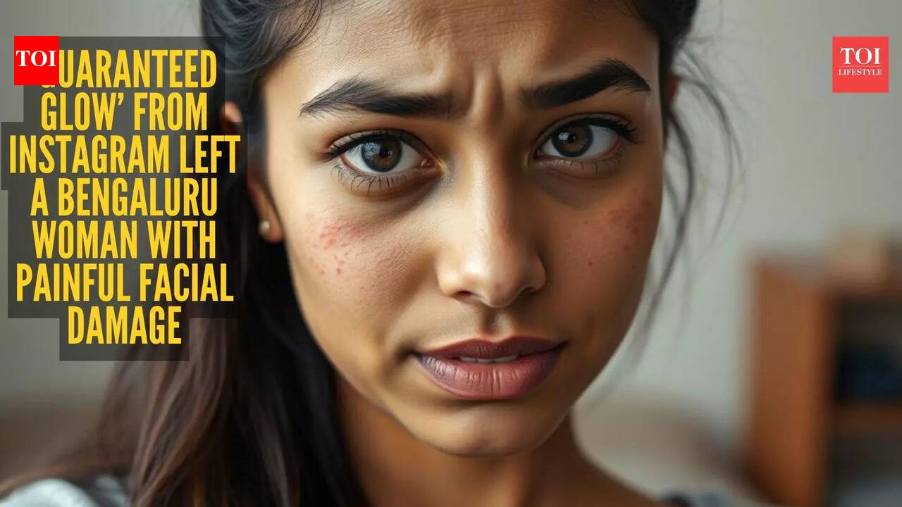 Bengaluru woman says Instagram beauty treatment left her face burned and swollen